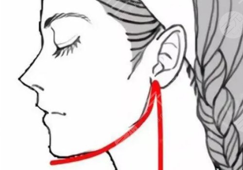 上海時(shí)光做下頜角怎么樣