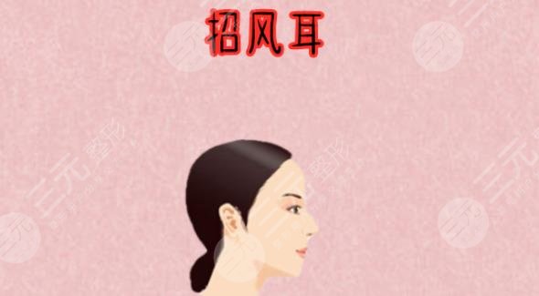 招風耳整形
