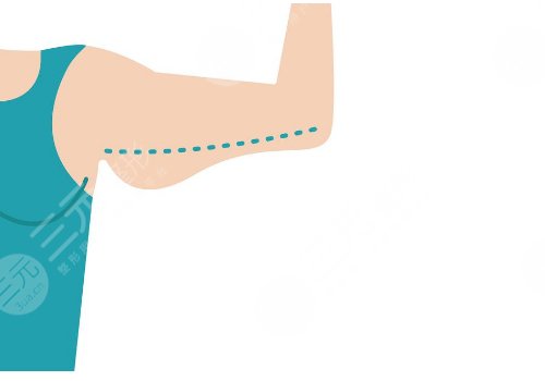 藝星彭才學(xué)抽胳膊怎么樣