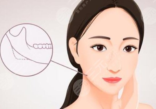 武漢同濟醫(yī)院磨骨手術費用