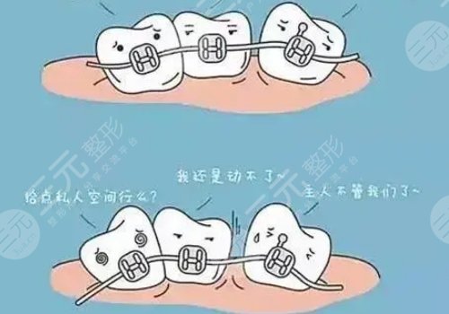 天津市口腔醫(yī)院牙齒矯正費用