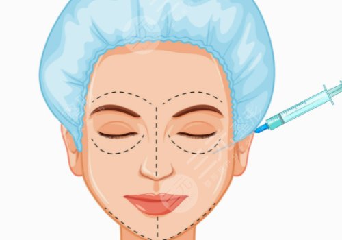 陳貞宜醫(yī)生技術(shù)優(yōu)勢