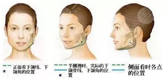 何晉龍醫(yī)生到底怎么樣?