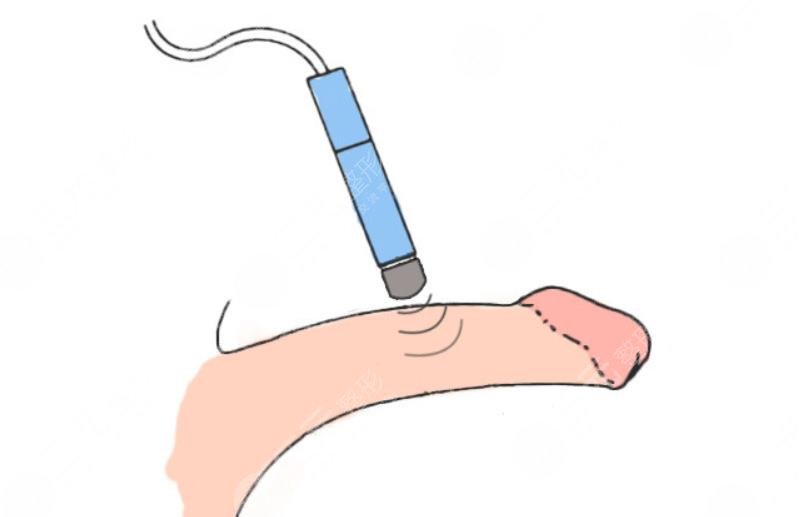 重慶生物補片手術