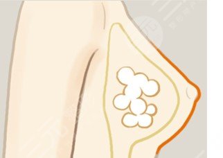 杭州公立醫(yī)院縮胸三巨頭