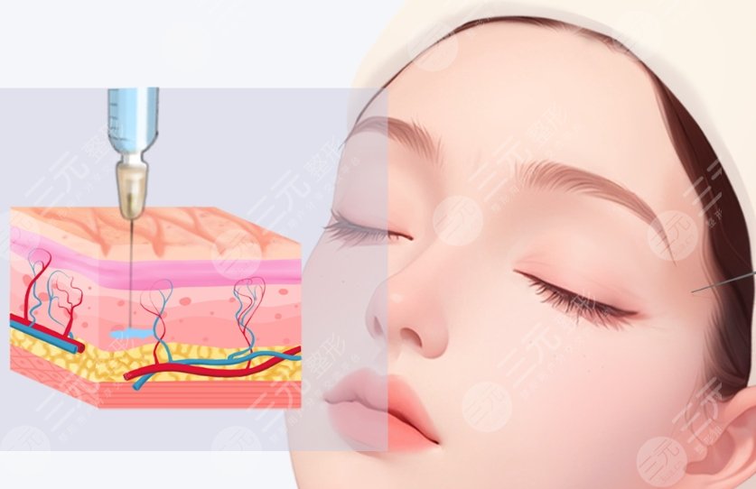 注射美容