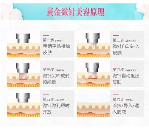 昆明黃金微針公立醫(yī)院TOP3