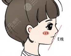 下巴后縮正頜手術(shù)怎么做的？從面診到拆板：下巴后縮手術(shù)180天實(shí)錄