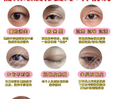 雙眼皮修復(fù)